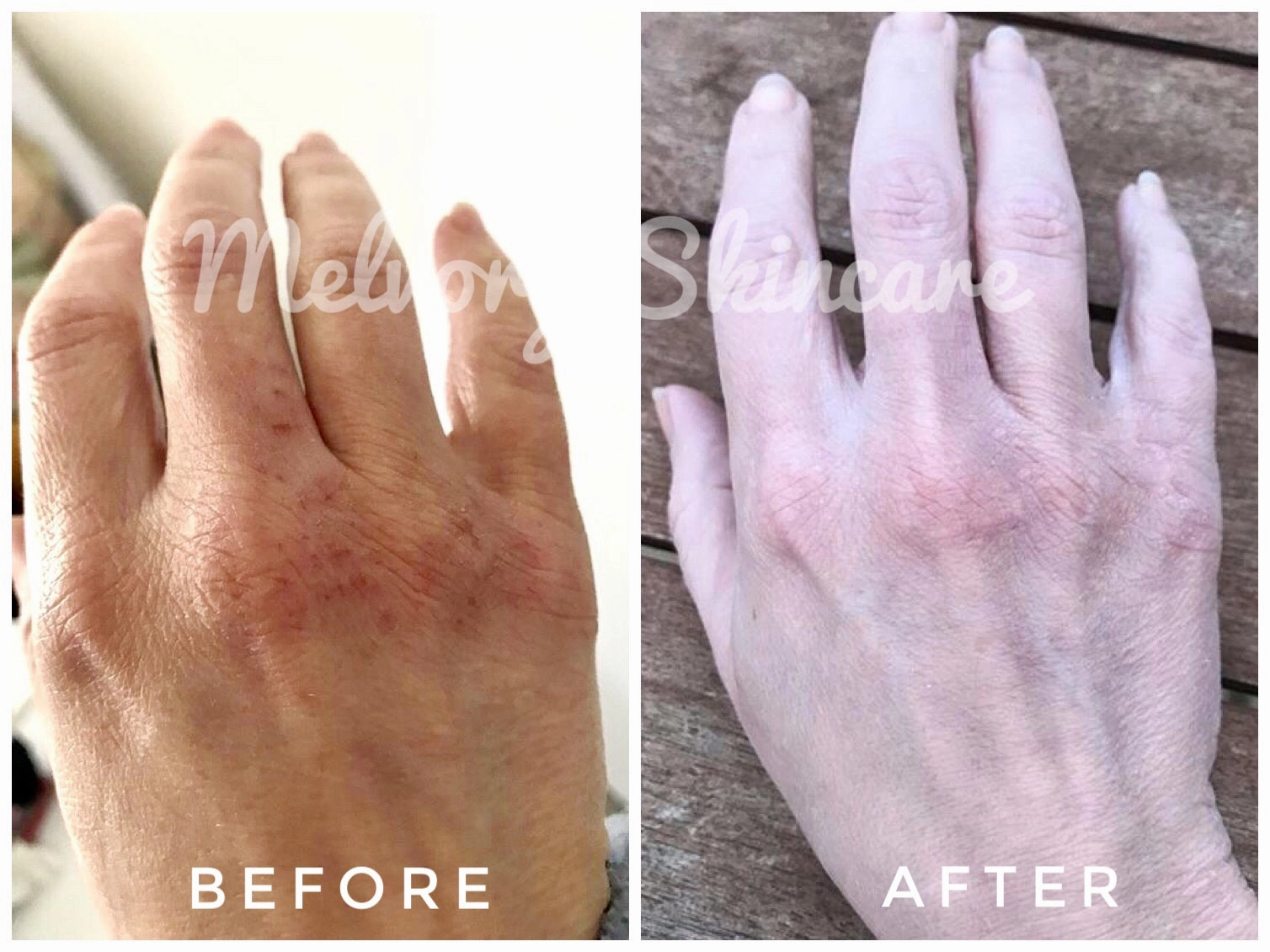 Raspberry Hand Cream